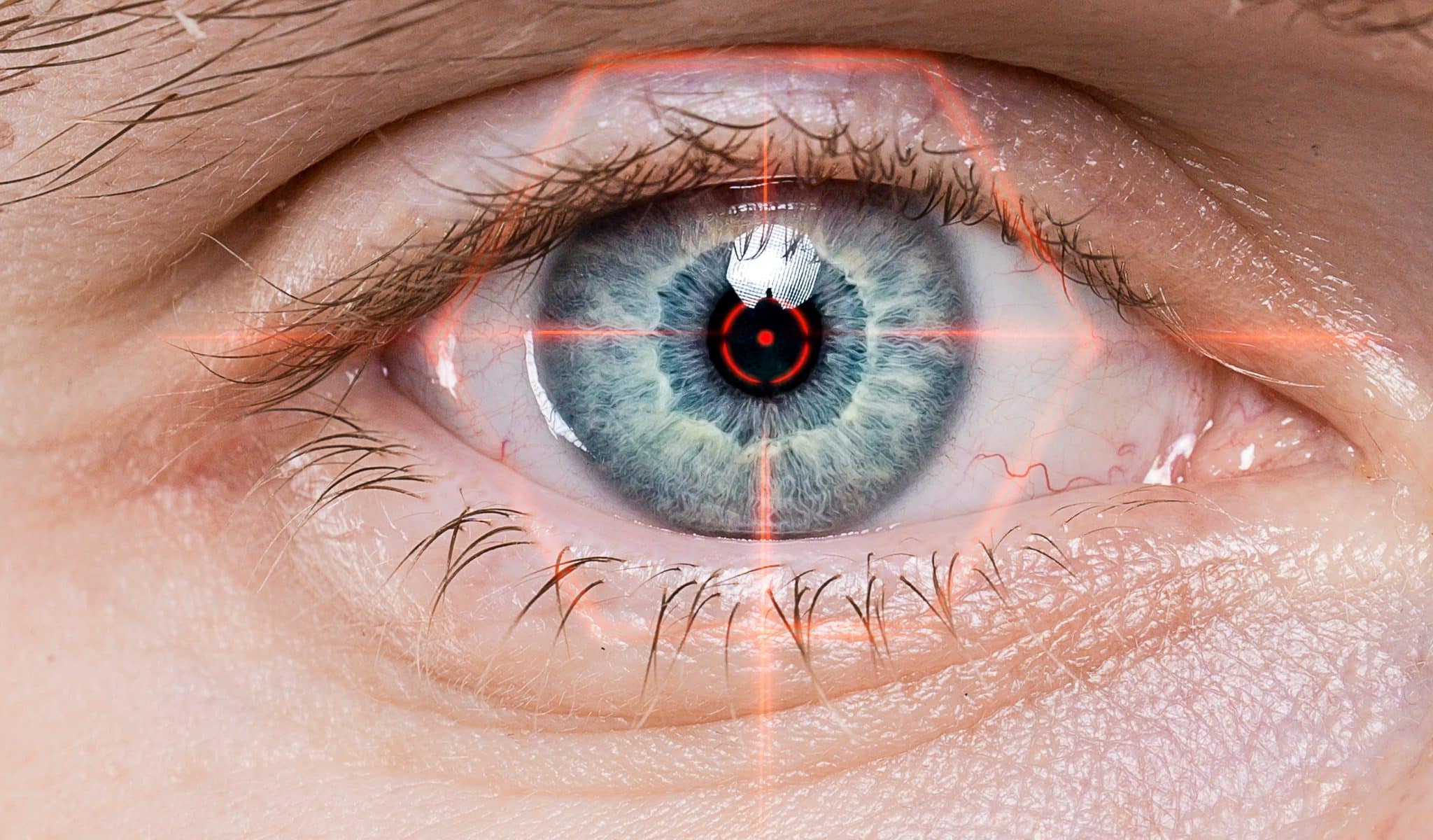 Chirurgie oculaire et yeux secs : un effet secondaire à ne pas négliger ! 👁️💧